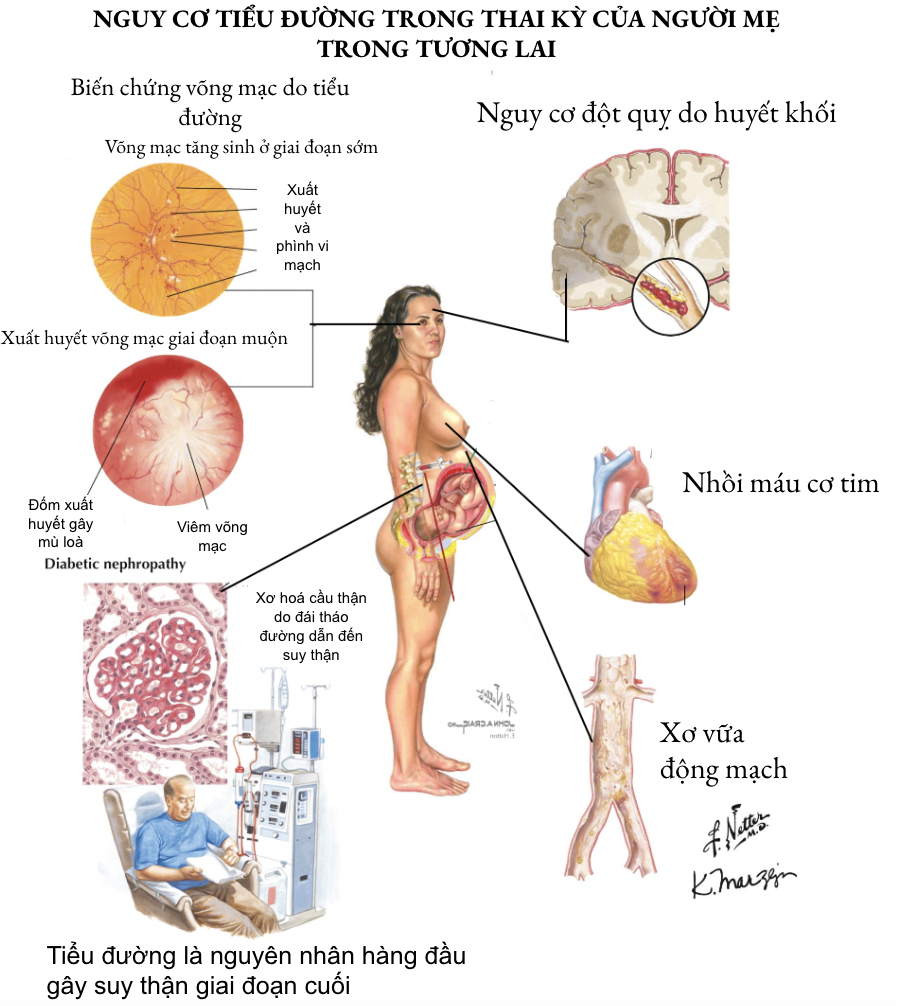 nguy-co